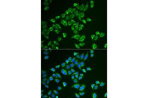 Immunofluorescence analysis of HeLa cells using TAGLN antibody (ABIN5974090). (Transgelin 抗体)