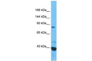 Host:  Rabbit  Target Name:  SFMBT1  Sample Type:  Esophagus tumor lysates  Antibody Dilution:  1. (SFMBT1 抗体  (Middle Region))