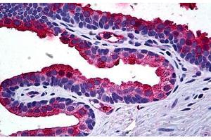Human Prostate: Formalin-Fixed, Paraffin-Embedded (FFPE) (TIMP2 抗体  (AA 27-221))