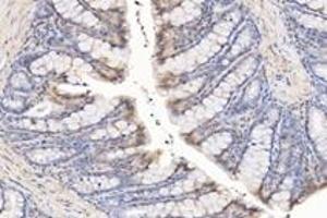 Immunohistochemistry analysis of paraffin-embedded rat rectum using,SYTL2 (ABIN7075797) at dilution of 1: 1600