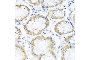 Immunohistochemistry of paraffin-embedded human stomach using PCDHA12 antibody at dilution of 1:100 (x40 lens). (PCDHA12 抗体)