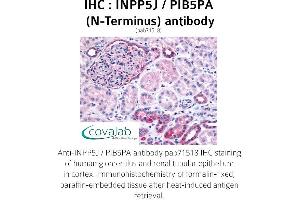 Image no. 1 for anti-Inositol Polyphosphate-5-Phosphatase J (INPP5J) (N-Term) antibody (ABIN1735940) (INPP5J 抗体  (N-Term))