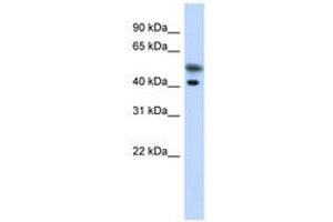 Image no. 1 for anti-Tropomodulin 2 (TMOD2) (N-Term) antibody (ABIN6741280) (TMOD2 抗体  (N-Term))