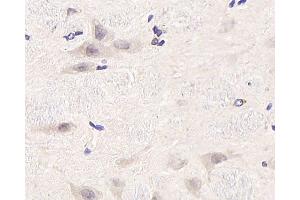 Immunohistochemistry analysis of paraffin-embedded rat brain using CDC25A Polyclonal Antibody at dilution of 1:1000. (CDC25A 抗体)