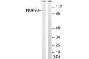 Western blot analysis of extracts from rat liver cells, using NUP93 Antibody. (NUP93 抗体  (AA 221-270))
