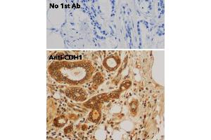 Immunohistochemistry (IHC) image for anti-Cadherin 1, Type 1, E-Cadherin (Epithelial) (CDH1) antibody (ABIN6254215) (E-cadherin 抗体)