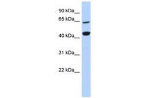 Image no. 1 for anti-Replication Factor C (Activator 1) 4, 37kDa (RFC4) (AA 287-336) antibody (ABIN6740953) (RFC4 抗体  (AA 287-336))