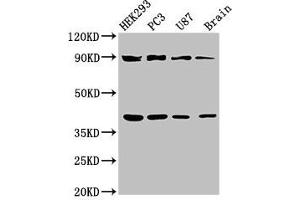 Western Blot Positive WB detected in: HEK293 whole cell lysate, PC-3 whole cell lysate, U87 whole cell lysate, Rat brain tissue All lanes: TRIM54 antibody at 3 μg/mL Secondary Goat polyclonal to rabbit IgG at 1/50000 dilution Predicted band size: 41, 45 kDa Observed band size: 41, 90 kDa (TRIM54 抗体  (AA 60-358))