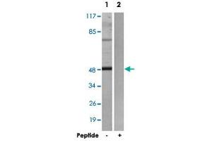 Western blot analysis of extracts from HepG2 cells, using ADRB2 polyclonal antibody . (beta 2 Adrenergic Receptor 抗体)