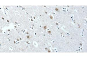 Immunohistochemistry of paraffin-embedded Human brain tissue using ACLY Polyclonal Antibody at dilution 1:40 (ACLY 抗体)