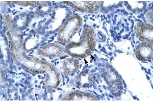 Immunohistochemistry (IHC) image for anti-Single-Stranded DNA Binding Protein 2 (SSBP2) (N-Term) antibody (ABIN2777444)
