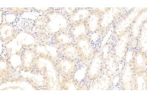 Detection of DKK4 in Human Kidney Tissue using Polyclonal Antibody to Dickkopf Related Protein 4 (DKK4) (DKK4 抗体  (AA 107-212))