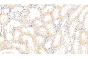 Detection of DKK4 in Human Kidney Tissue using Polyclonal Antibody to Dickkopf Related Protein 4 (DKK4)