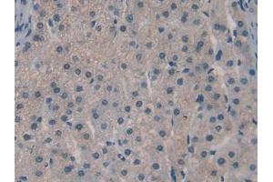 IHC-P analysis of Human Liver Tissue, with DAB staining. (SPRY3 抗体  (AA 91-288))