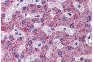 Human Liver: Formalin-Fixed, Paraffin-Embedded (FFPE) (TMPRSS6 抗体  (AA 71-120))