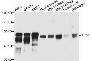 Western blot analysis of extracts of various cells, using TP53 antibody. (p53 抗体)