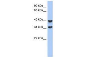 Image no. 1 for anti-Chromosome 5 Open Reading Frame 35 (C5orf35) (AA 71-120) antibody (ABIN6741237) (C5orf35 抗体  (AA 71-120))