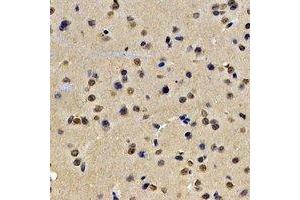 Immunohistochemical analysis of Lamin B2 staining in rat brain formalin fixed paraffin embedded tissue section. (Lamin B2 抗体)