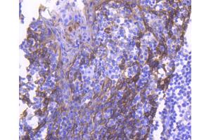 Paraformaldehyde-fixed, paraffin embedded human tonsil, Antigen retrieval by boiling in sodium citrate buffer (pH6) for 15min, Block endogenous peroxidase by 3% hydrogen peroxide for 30 minutes, Blocking buffer at 37°C for 20min, Antibody incubation with Cytokeratin 4 (2F9) Monoclonal Antibody  at 1:50 overnight at 4°C, followed by a conjugated secondary and DAB staining. (KRT4 抗体)