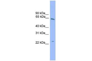WB Suggested Anti-HSPB8 Antibody Titration: 0. (HSPB8 抗体  (Middle Region))