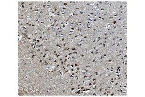 IHC analysis of MAPK1 using anti-MAPK1 antibody (ABIN7600772). (MAPK11 抗体  (AA 230-364))