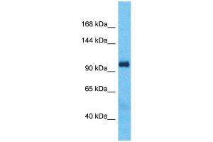 Host:  Rabbit  Target Name:  BOC  Sample Type:  Fetal Lung lysates  Antibody Dilution:  1. (BOC 抗体  (Middle Region))