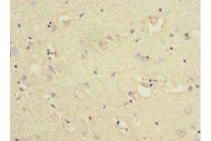 Immunohistochemistry of paraffin-embedded human brain tissue using ABIN7157566 at dilution of 1:100 (KLC1 抗体  (AA 274-573))