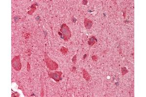 Human Brain, Cortex: Formalin-Fixed, Paraffin-Embedded (FFPE).