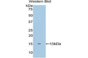 Detection of Recombinant KRT2, Human using Polyclonal Antibody to Keratin 2 (CK2) (Keratin 2 抗体  (AA 7-160))