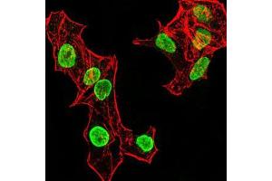Immunofluorescence analysis of HeLa cells using HIST2H4A(20Me) mouse mAb (green). (Histone Cluster 2, H4a (HIST2H4A) (meLys20) 抗体)