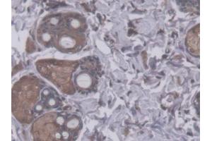 DAB staining on IHC-P; Samples: Rat Skin Tissue (RHAG 抗体  (AA 251-450))