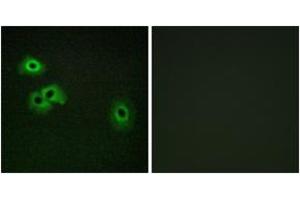 Immunofluorescence analysis of HepG2 cells, using Calmodulin (Phospho-Thr79+Ser81) Antibody. (Calmodulin 1 抗体  (pThr79))