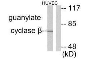 Western blot analysis of extracts from HuvEc cells, using Guanylate Cyclase β antibody. (GUCY1B3 抗体)