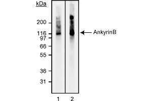 Western Blotting (WB) image for anti-Ankyrin 2, Neuronal (ANK2) antibody (ABIN967633)