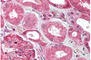Human Kidney (formalin-fixed, paraffin-embedded) stained with UBE2N antibody ABIN214016 at 2. (UBE2N 抗体  (C-Term))