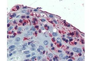 Immunohistochemistry (IHC) image for anti-Integrin, alpha X (Complement Component 3 Receptor 4 Subunit) (ITGAX) antibody (ABIN2478280)