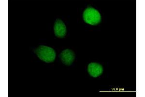 Immunofluorescence of purified MaxPab antibody to TSEN2 on HeLa cell. (TSEN2 抗体  (AA 1-465))