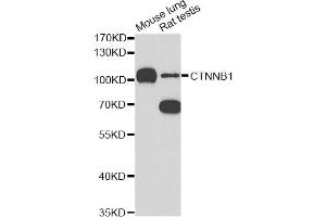 Western blot analysis of extracts of various cell lines, using CTNNB1 antibody (ABIN5997534) at 1/1000 dilution. (CTNNB1 抗体)