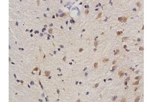 Formalin-fixed and paraffin embedded rat brain tissue labeled with Anti phospho-REC8(Ser251) Polyclonal Antibody, Unconjugated  followed by conjugation to the secondary antibody and DAB staining (REC8 抗体  (pSer251))