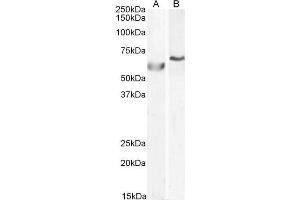 ABIN185143 (0. (POLL 抗体  (C-Term))
