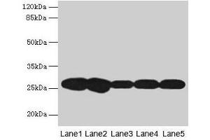 Western blot All lanes: FKBP3 antibody at 4 μg/mL Lane 1: Hela whole cell lysate Lane 2: A431 whole cell lysate Lane 3: PC-3 whole cell lysate Lane 4: Jurkat whole cell lysate Lane 5: 293T whole cell lysate Secondary Goat polyclonal to rabbit IgG at 1/10000 dilution Predicted band size: 26 kDa Observed band size: 26 kDa (FKBP3 抗体  (AA 2-224))