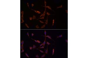 anti-Methylthioadenosine phosphorylase (MTAP) antibody
