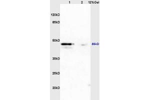 Lane 1: mouse uterus lysates Lane 2: mouse brain lysates probed with Anti PAX2 Polyclonal Antibody, Unconjugated (ABIN738951) at 1:200 in 4 °C. (PAX2A 抗体)