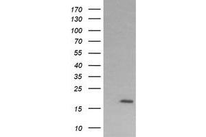 Image no. 2 for anti-Cancer/testis Antigen 1B (CTAG1B) antibody (ABIN1499903) (CTAG1B 抗体)