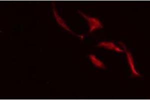 ABIN6275484 staining HeLa cells by IF/ICC. (Repetin 抗体  (C-Term))