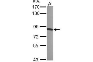 Western Blotting (WB) image for anti-Radixin (RDX) antibody (ABIN2856100)