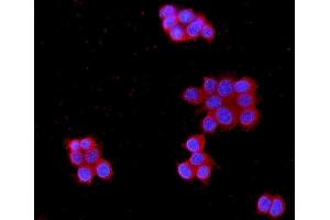 IF analysis of MPP1 using anti-MPP1 antibody (ABIN4886673).