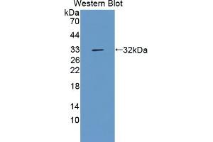 Detection of Recombinant AGC, Cattle using Polyclonal Antibody to Aggrecan (AGC) (Aggrecan 抗体  (AA 2066-2316))