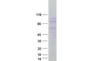 Western Blotting (WB) image for CTD (Carboxy-Terminal Domain, RNA Polymerase II, Polypeptide A) Small Phosphatase Like 2 (CTDSPL2) (C-Term) protein (Myc-DYKDDDDK Tag) (ABIN2718870)