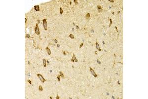 Immunohistochemistry of paraffin-embedded rat brain using APLP1 antibody at dilution of 1:200 (400x lens). (APLP1 抗体)